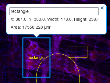 omero-image-viewer-ROI-commentary-on